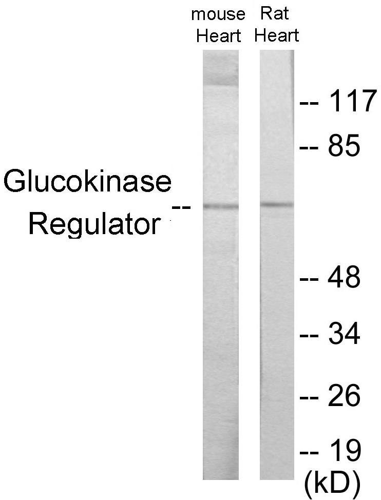 Glucokinase Regulator Cell Based ELISA Kit