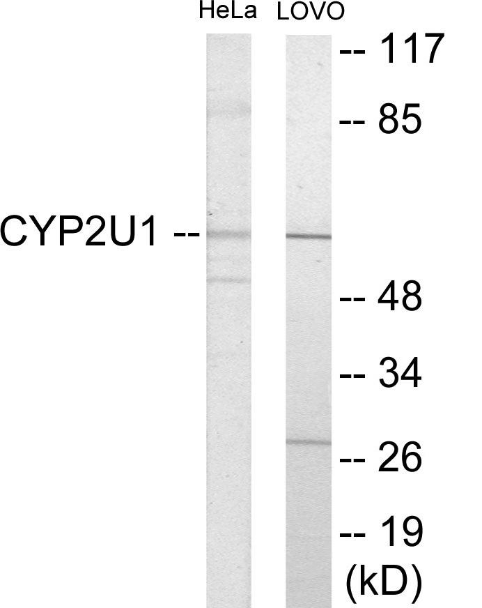 Cytochrome P45 02U1 Cell Based ELISA Kit
