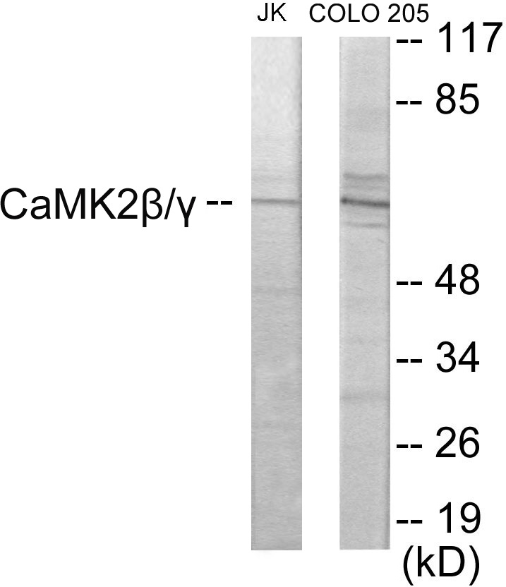 CaMK2 beta + gamma Cell Based ELISA Kit
