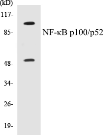 NFkB p100 / p52 Cell Based ELISA Kit