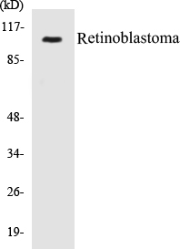 Retinoblastoma Cell Based ELISA Kit