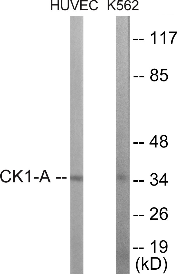 CKI alpha Cell Based ELISA Kit