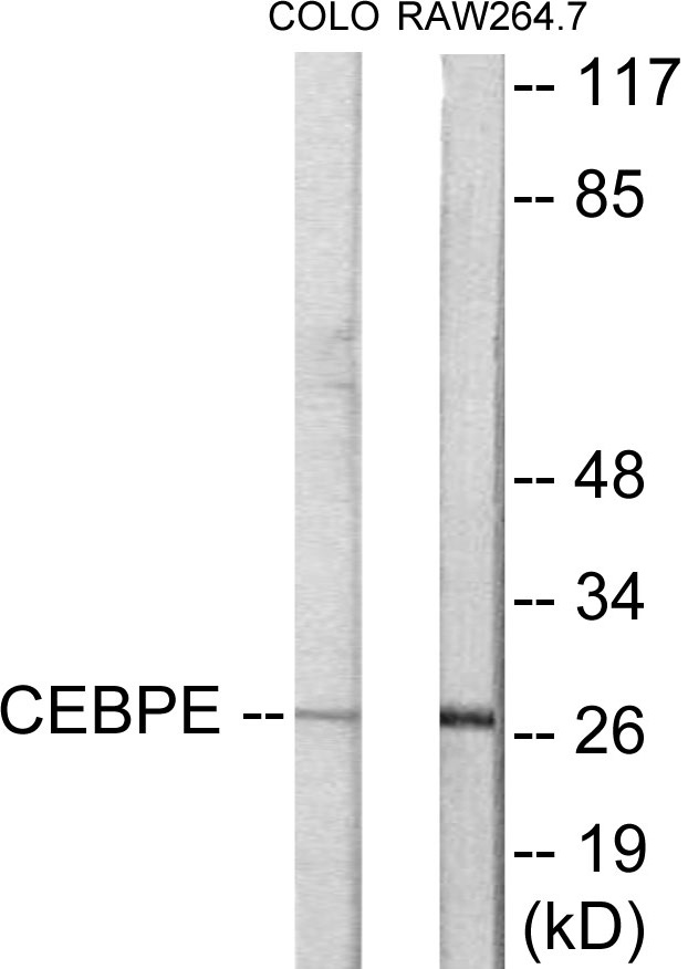 CEBPD + E Cell Based ELISA Kit