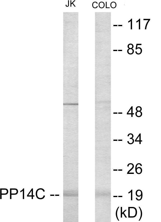 PPP1R14C Cell Based ELISA Kit