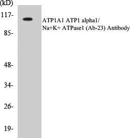 ATP1A1 Cell Based ELISA Kit
