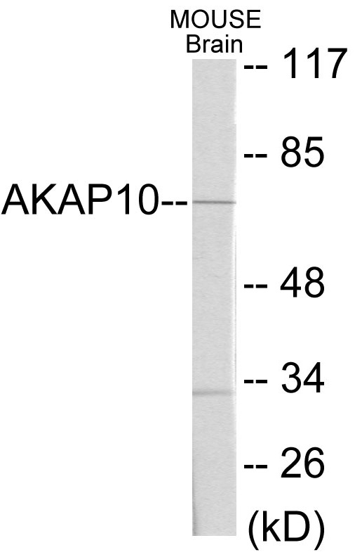 AKAP10 Cell Based ELISA Kit