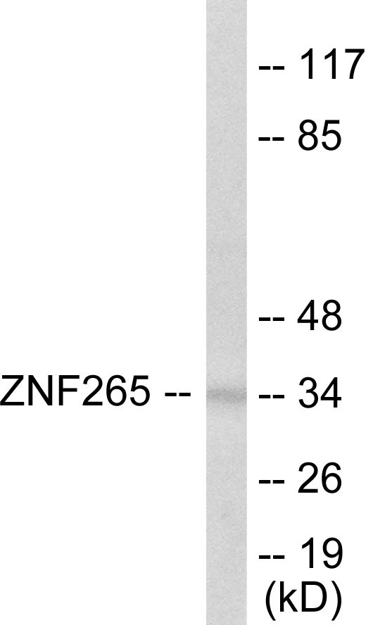 ZNF265 Cell Based ELISA Kit