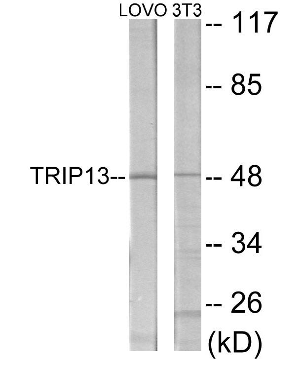 TRIP13 Cell Based ELISA Kit