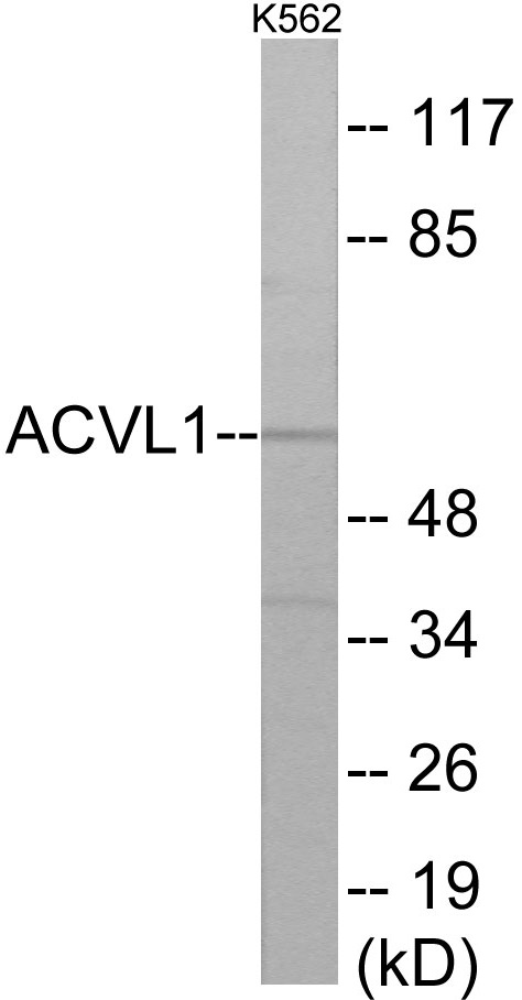 ACVL1 Cell Based ELISA Kit