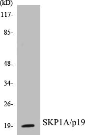 SKP1A Cell Based ELISA Kit
