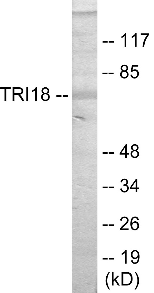 TRI18 Cell Based ELISA Kit