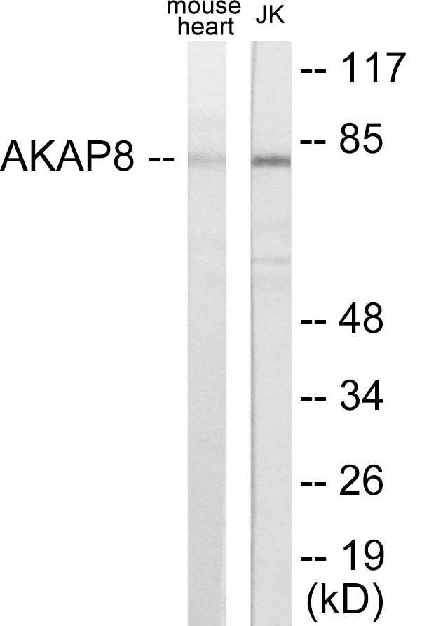 AKAP8 Cell Based ELISA Kit