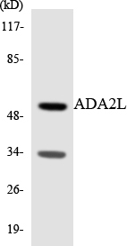 ADA2L Cell Based ELISA Kit