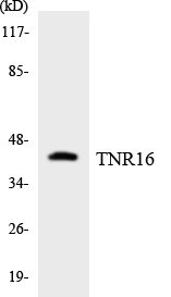 TNR16 Cell Based ELISA Kit