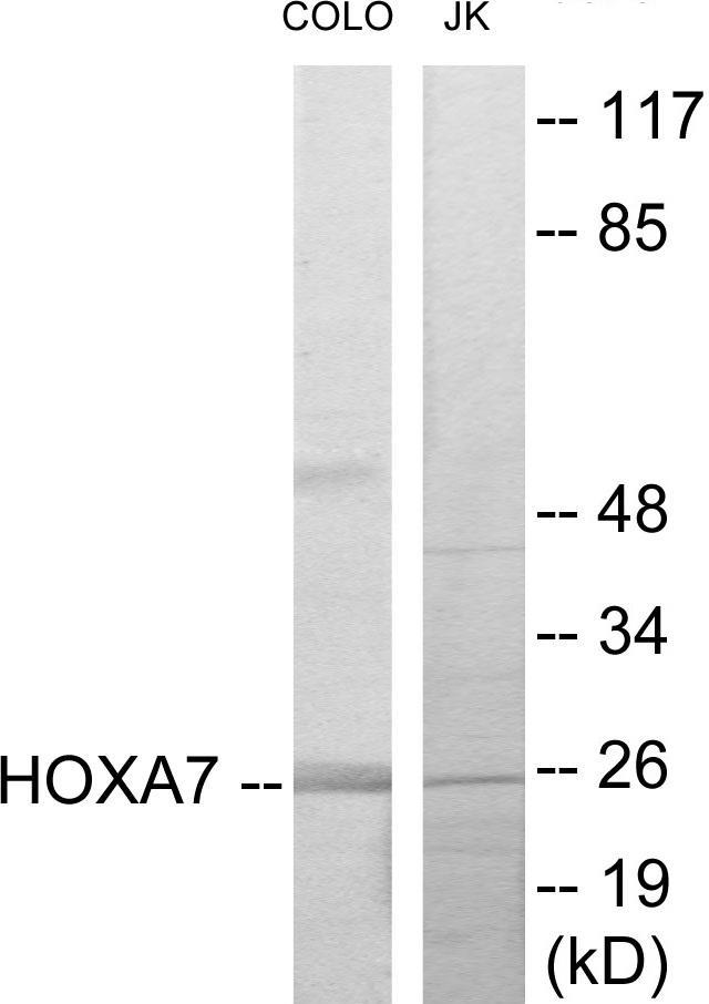 HOXA7 Cell Based ELISA Kit