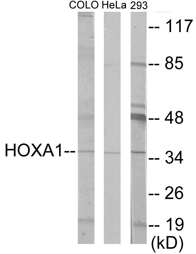 HOXA1 Cell Based ELISA Kit