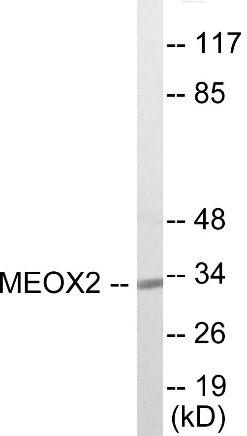 MEOX2 Cell Based ELISA Kit