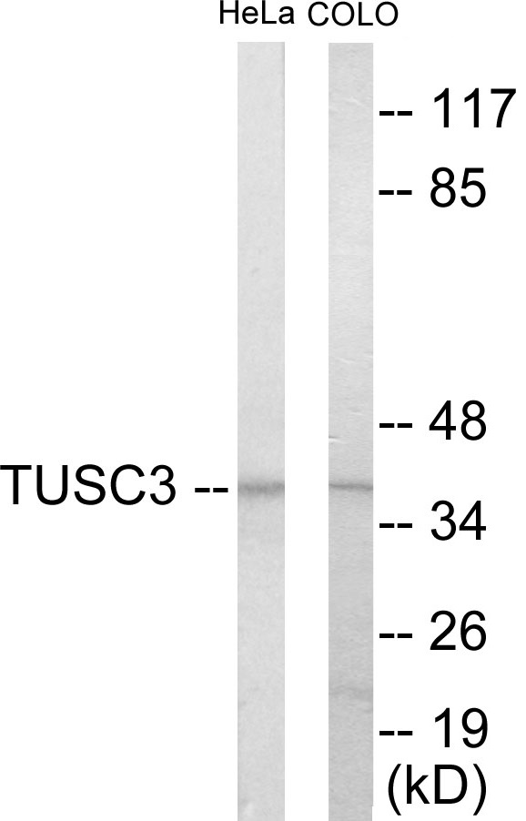 TUSC3 Cell Based ELISA Kit