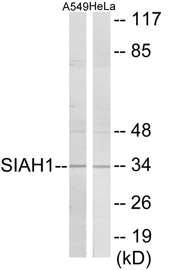 SIAH1 Cell Based ELISA Kit