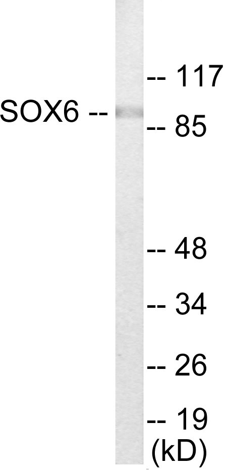 SOX6 Cell Based ELISA Kit