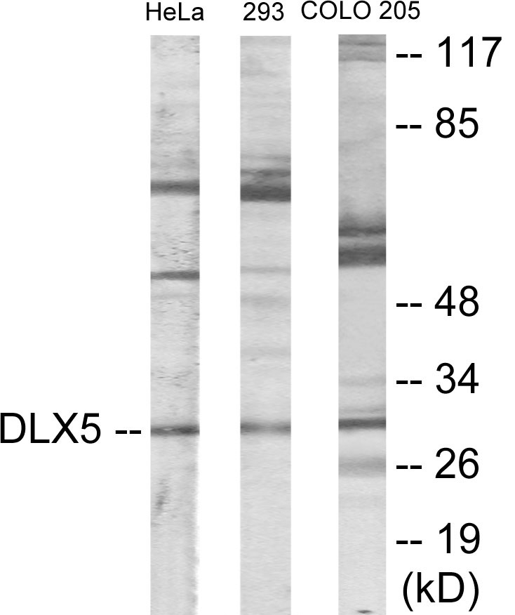 DLX5 Cell Based ELISA Kit