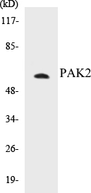 PAK2 Cell Based ELISA Kit