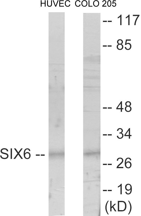 SIX6 Cell Based ELISA Kit