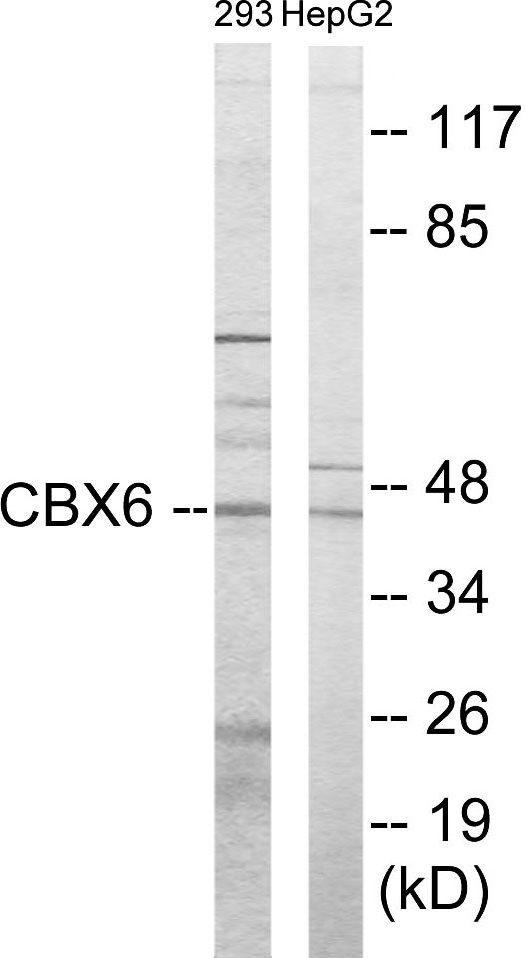 CBX6 Cell Based ELISA Kit