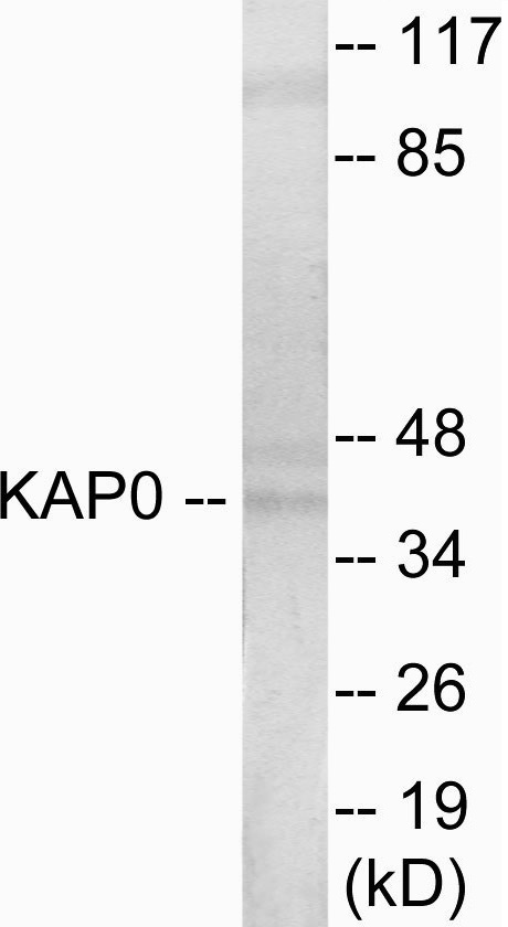 KAP0 Cell Based ELISA Kit