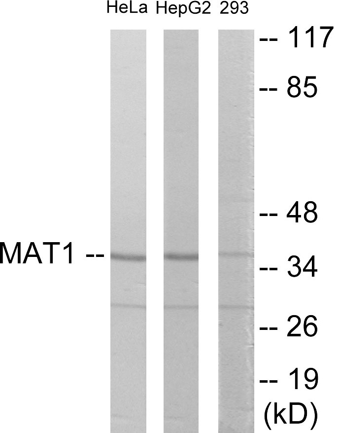 MAT1 Cell Based ELISA Kit