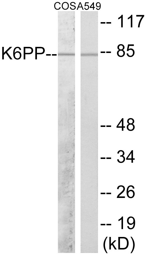 K6PP Cell Based ELISA Kit