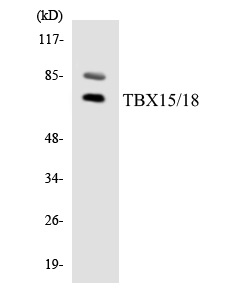 TBX15 + 18 Cell Based ELISA Kit