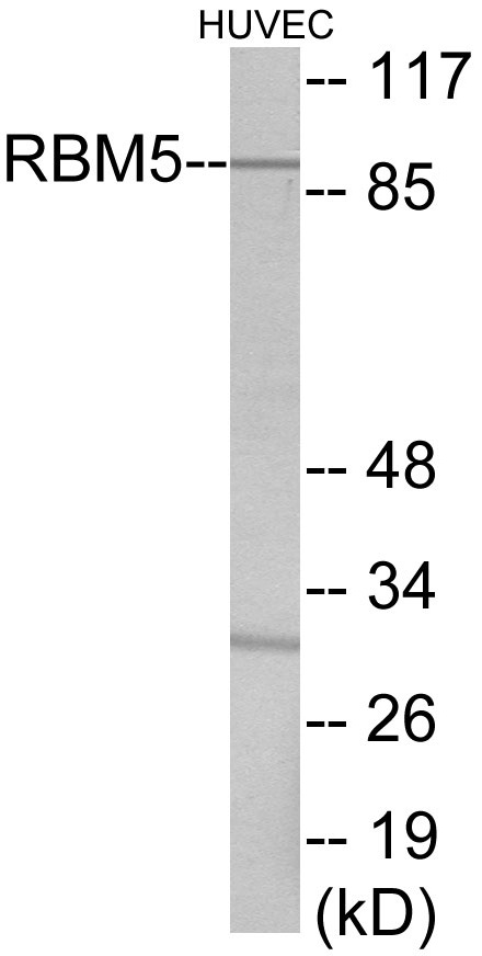 RBM5 Cell Based ELISA Kit