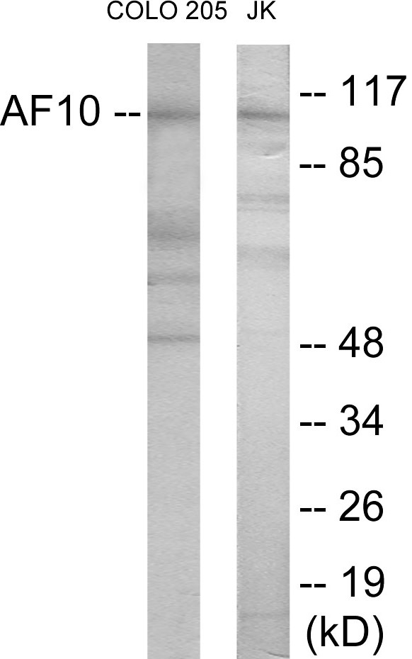 AF10 Cell Based ELISA Kit