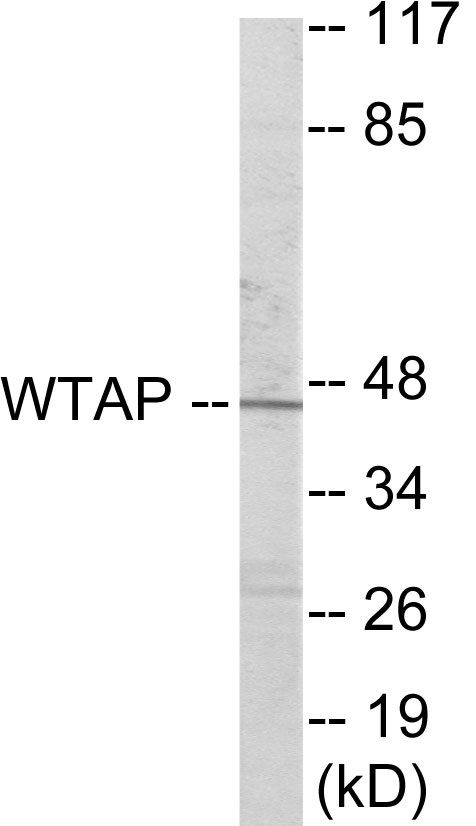 WTAP Cell Based ELISA Kit