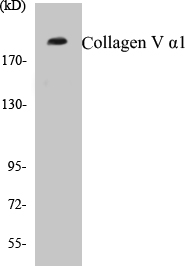 Collagen V alpha 1 Cell Based ELISA Kit