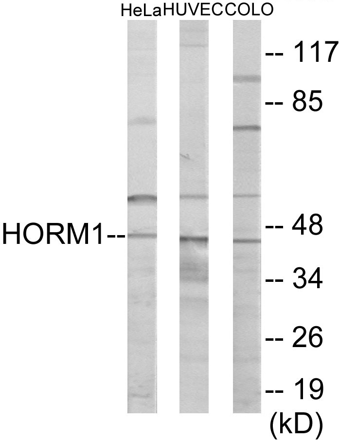 HORMAD1 Cell Based ELISA Kit