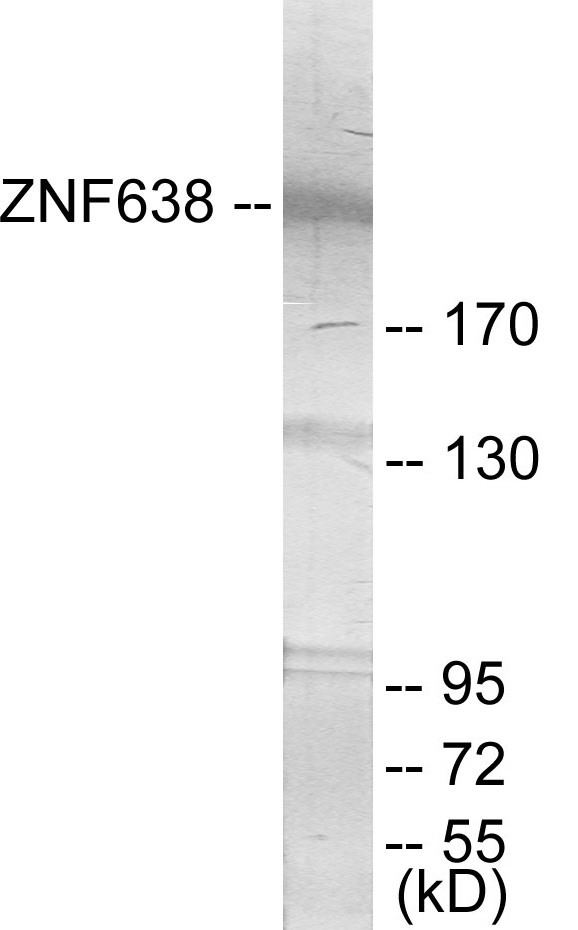 ZNF638 Cell Based ELISA Kit