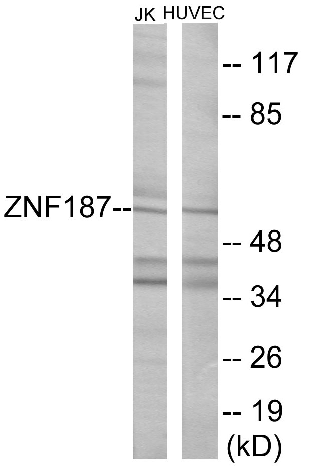 ZNF187 Cell Based ELISA Kit