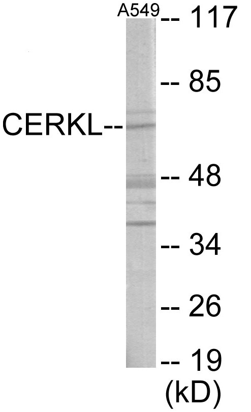 CERKL Cell Based ELISA Kit