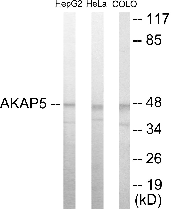AKAP5 Cell Based ELISA Kit