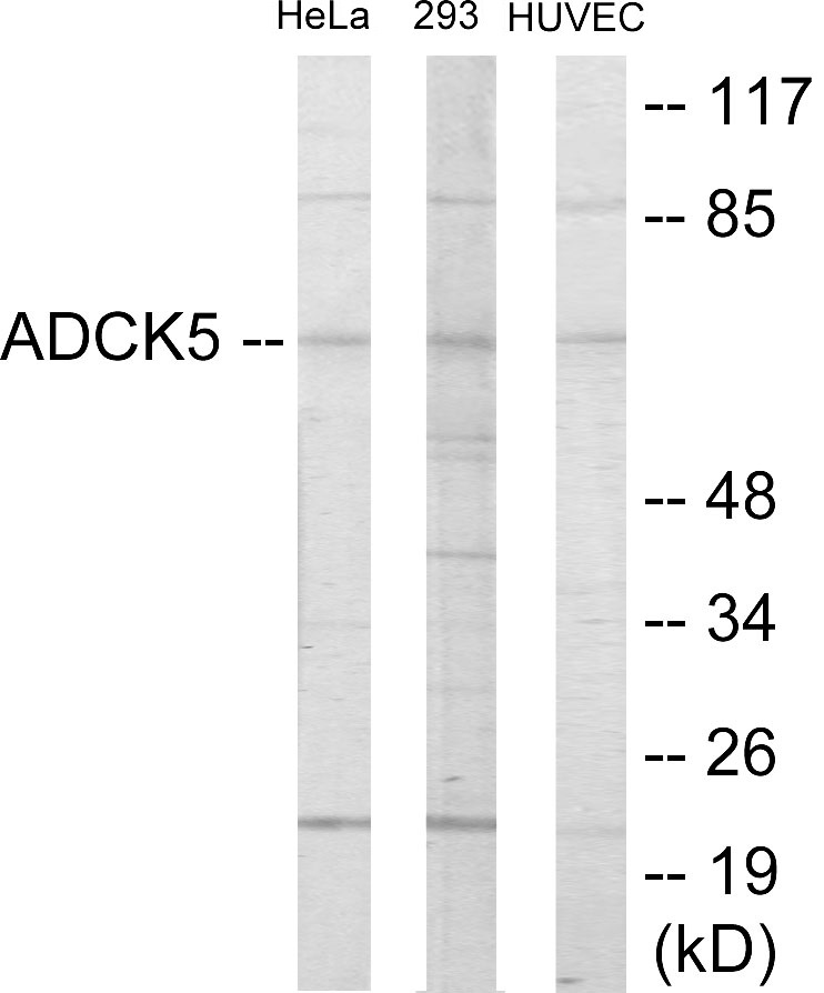 ADCK5 Cell Based ELISA Kit
