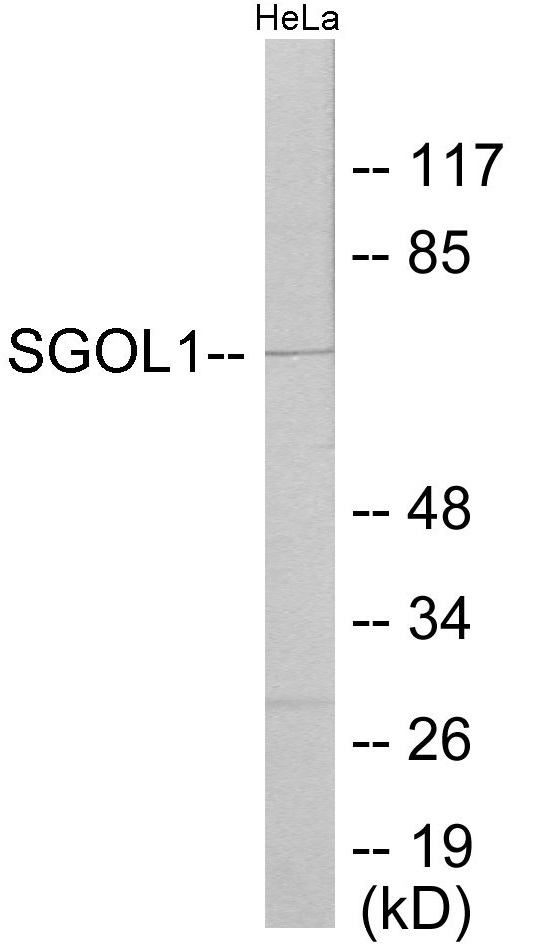 SGOL1 Cell Based ELISA Kit