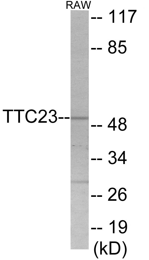 TTC23 Cell Based ELISA Kit