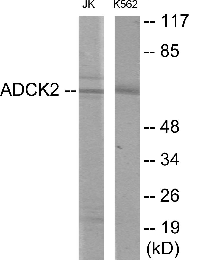 ADCK2 Cell Based ELISA Kit
