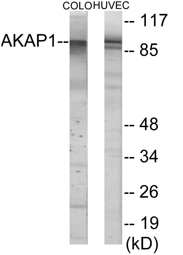 AKAP1 Cell Based ELISA Kit