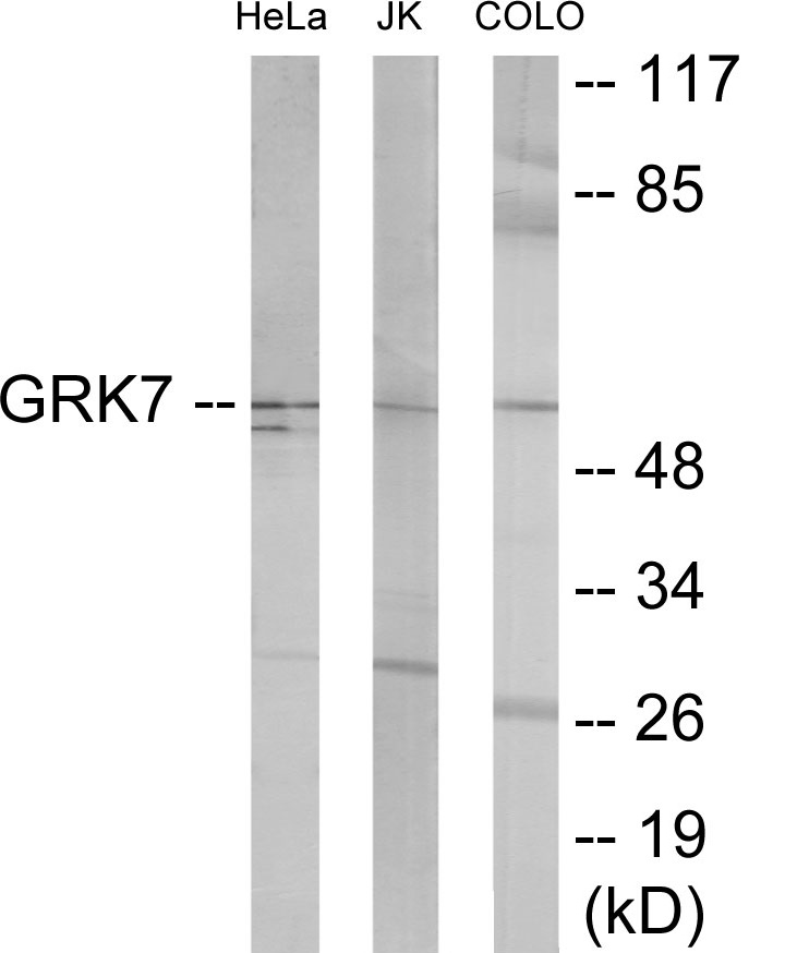 GRK7 Cell Based ELISA Kit