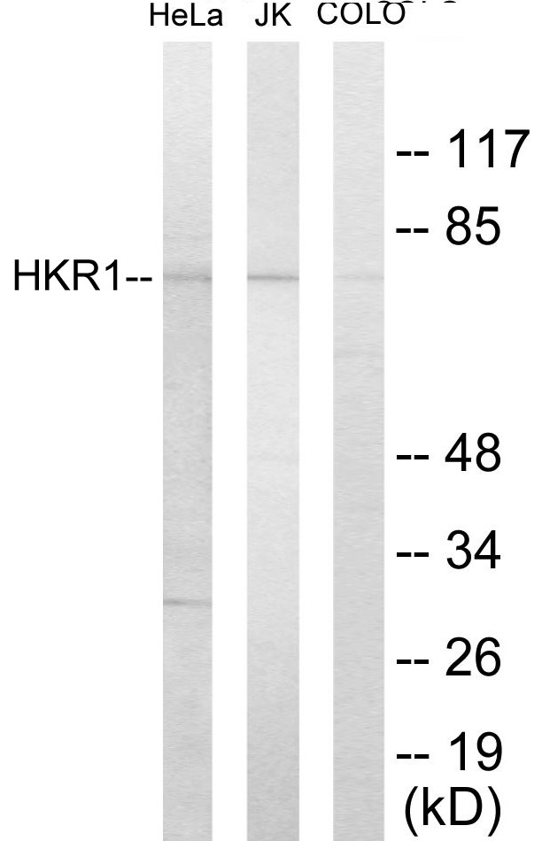 HKR1 Cell Based ELISA Kit