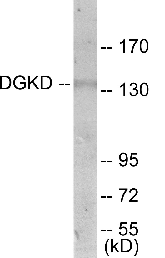 DGKD Cell Based ELISA Kit