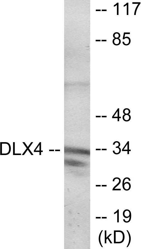 DLX4 Cell Based ELISA Kit